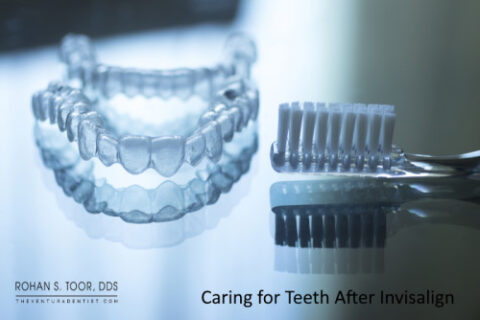 Caring for Teeth After Invisalign