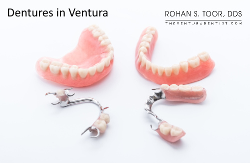 Dentures in Ventura