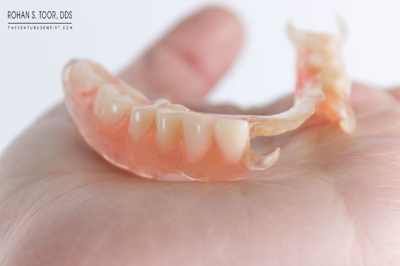 flexible nylon partial dentures