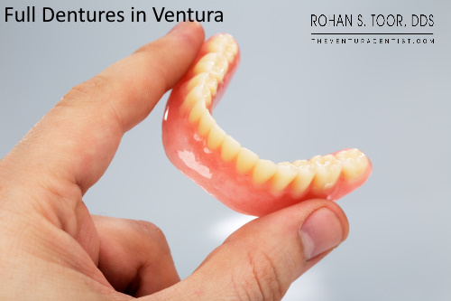 Complete Dentures in Ventura