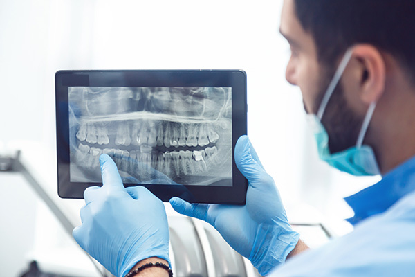 General Dentistry: Are Dental X-rays Recommended? from Rohan S. Toor, DDS & David M. Satnick, DMD in Ventura, CA
