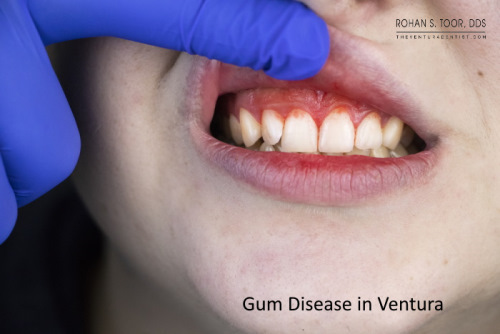 Dr. Rohan S. Toor DDS Gum Disease Dentist for Ventura community