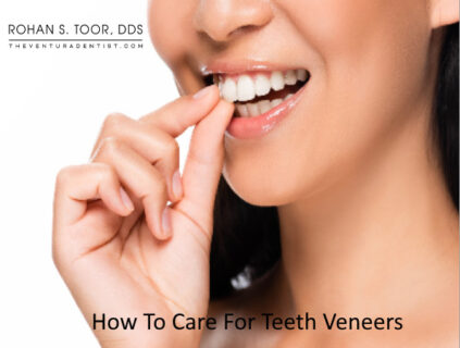 How To Care For Teeth Veneers